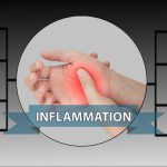 Inflammation Is The Primary Cause Of Almost All Disease – Here Are The Natural Ways To Prevent It
