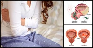 Urinary Tract Infection (UTI): What Foods To Eat And What To Avoid | Dr ...